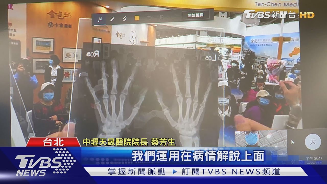 亞洲最大「醫療科技展」 防疫零接觸成亮點