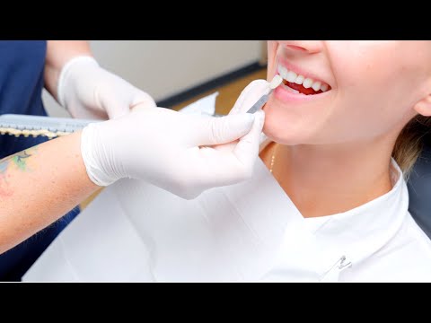 #howto fläsh In-Office Bleaching 01 von 08:  Vorbereiten der Behandlung