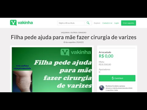 [VAKINHA] Ajuda para uma cirurgia de varizes