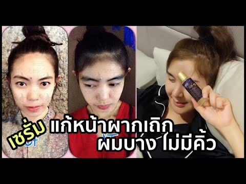 กลากภาพบนหัวเข่าของเขาในเด็ก กลากบุหรี่ภาพมือ