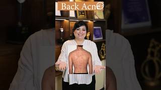 How to get rid of back acne? | Back acne treatment | Lacne Body Spray | Best dermatologist in Delhi