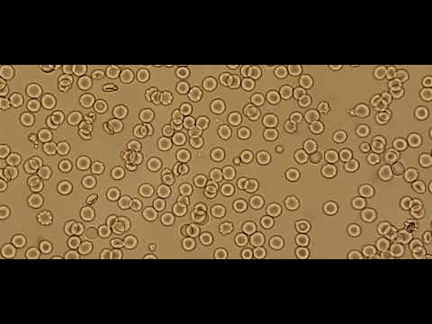 Compatible Cross-matching under a microscope.