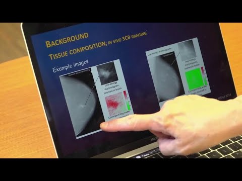 Reducing unnecessary breast biopsies