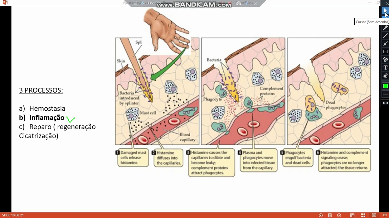 Enfermagem | PATOLOGIA | Reparo Tecidual