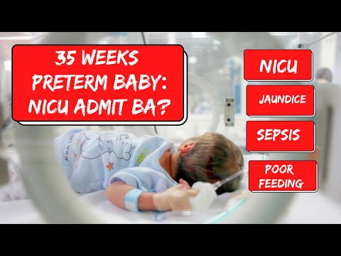 35 Weeks PRETERM BABY: Kailan ADMIT sa NICU? #35weeks #pretermbaby #jaundice #feeding