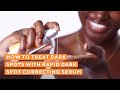 The 101 On Rapid Dark Spot Correcting Serum | Treat Dark Spots & Hyperpigmentation | Murad Skincare