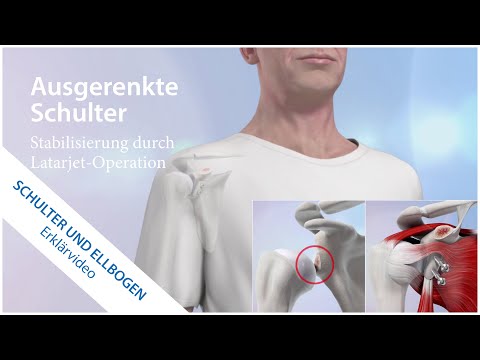 Zastuzhena Hals Kopfschmerzen Von schmerzenden Gelenken