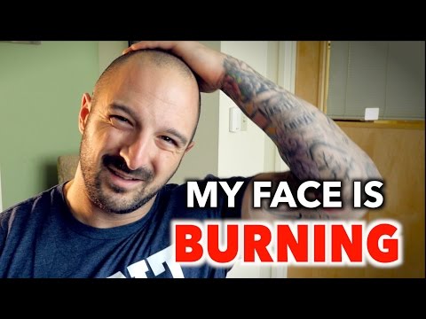 MY FACE FEELS LIKE IT'S BURNING! |Prescribed  Benzo Taper Update 5 Weeks (Klonopin/Clonazepam)