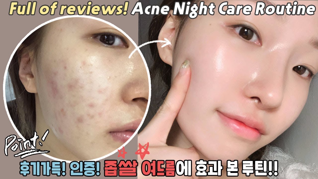 cc) 따라하면 좁쌀여드름 박멸‼️인증/후기가득🙆🏻‍♀️ 피부좋아지는법ㅣ아랑