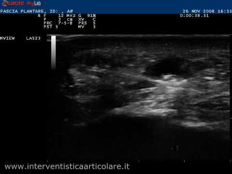 A causa di gastrite mal di schiena Osteocondrosi della colonna vertebrale cervicale tutto è buono