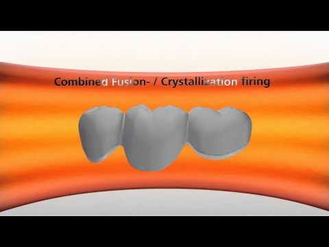 Henry Schein UK -- IPS e.max CAD