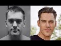 How To Improve Your Facial Attractiveness (FULL GUIDE)