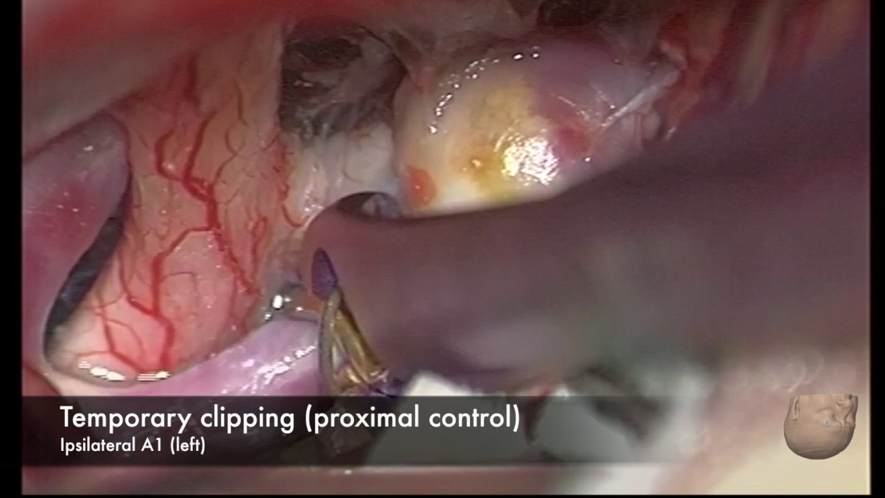 Juan Martino Gonzalez-3