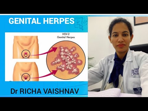 Genital herpes in females # painful ulcers in private area by Dr Richa Vaishanav, Jaipur .