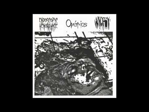 Anopsy - Eating a Perverted