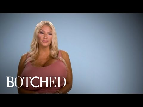 Allegra Explains Her Growing Giant Breasts | Botched | E!