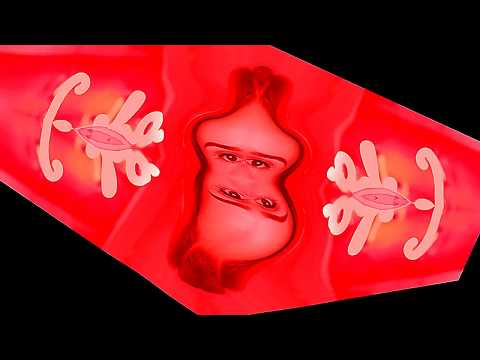 МБ Пакет - Как я к психиатру ходил