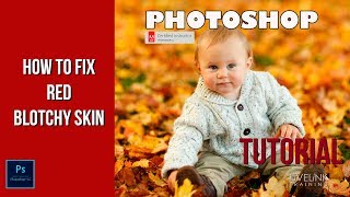 How to Fix Red Blotchy Skin: Photoshop Tutorial