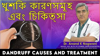 How To Get Rid of Dandruff ? | খুশকি | home remedies for dandruff | Dr Anand K. Nagwani
