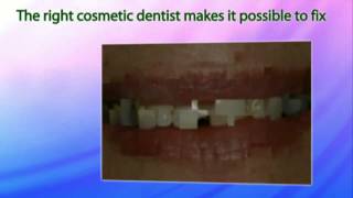 preview picture of video 'Cosmetic Dentist League City TX - Call (832) 632-9117'