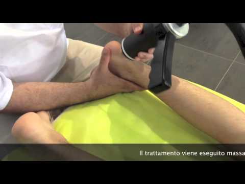 CTU MEGA 18 POMPA DIAMAGNETICA. DIAMAGNETOTERAPIA NELLA TENDINITE ACHILLEA