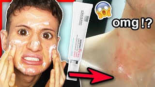 I tried La Roche Posay Redermic R Retinol for THREE WEEKS!! (my skin reacted badly...)