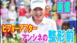 アンシネの整形前ビフォーアフター画像！すっぴんもスゴイ！・・・【韓国 報道 SP】