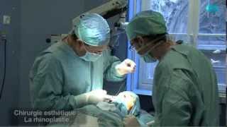 preview picture of video 'Rhinoplastie par le Dr Mamlouk Chirurgien Esthetique Paris'