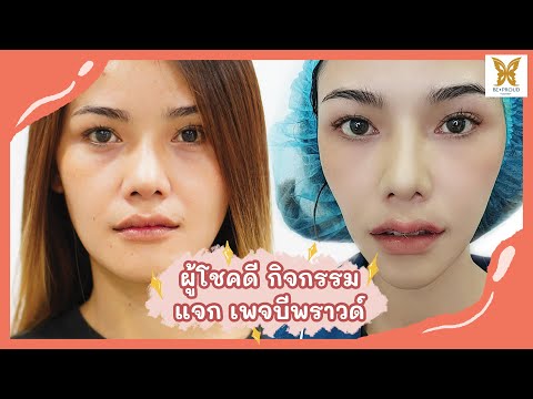 ทําปากกระจับ