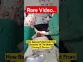 Newborn Pregnancy Pakistan India Bangladesh Gynaecologist Doctor Ytshorts Rare