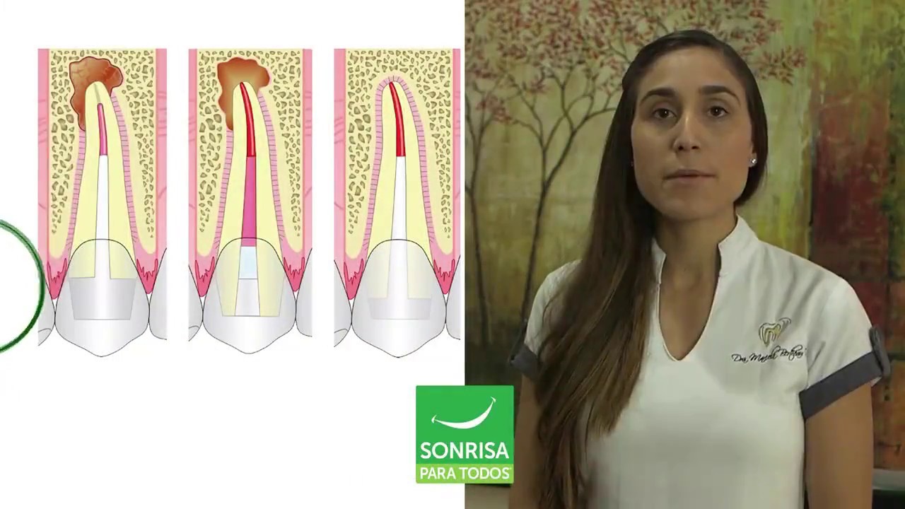 What is retreatment?