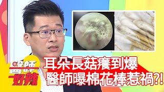 耳朵長菇癢到爆！醫師曝「棉花棒」惹禍？！【#醫師好辣】20210304 part2 EP1109 陳木榮 宋明樺
