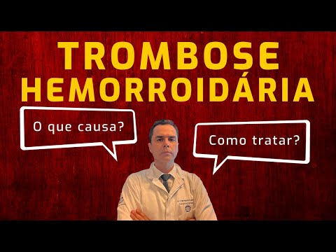 Trombose Hemorroidária! Causas e Tratamento. Dr. Fernando Lemos - Planeta Intestino
