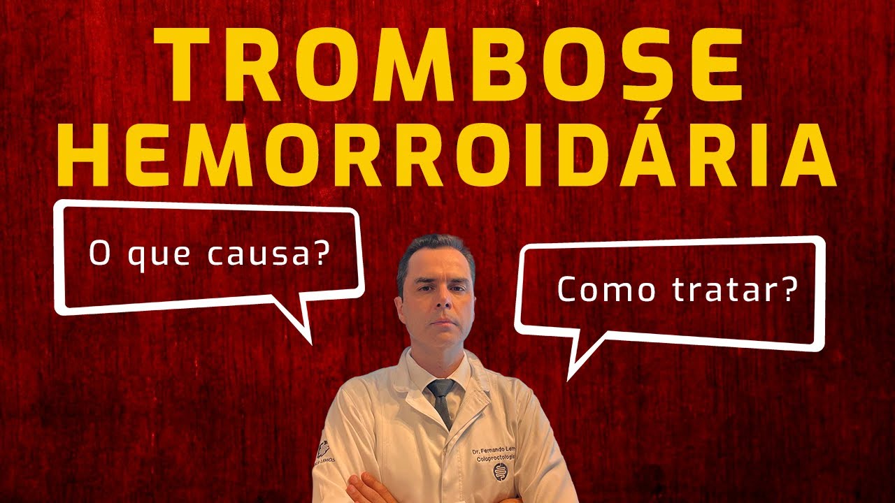 Trombose Hemorroidária! Causas e Tratamento. Dr. Fernando Lemos - Planeta Intestino