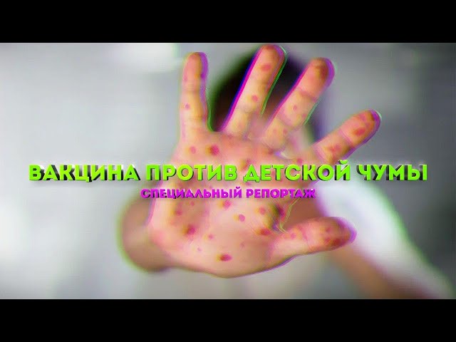 Корь. Чем опасна эта инфекция?