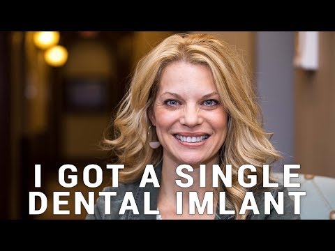 Capable, knowledgeable, and gentle - Dr. Kazmer replaced my failed root canal with a dental implant