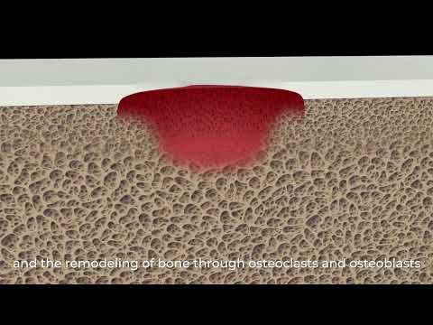 Tomir Kosowski, Altach Biomedical Limited - Biomimetic scaffolds for cartilage repair | LSI USA '26