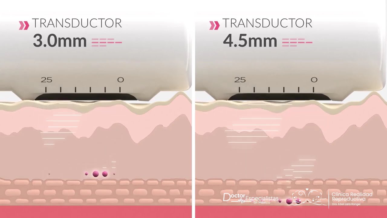 Edali Lara Rangel-36