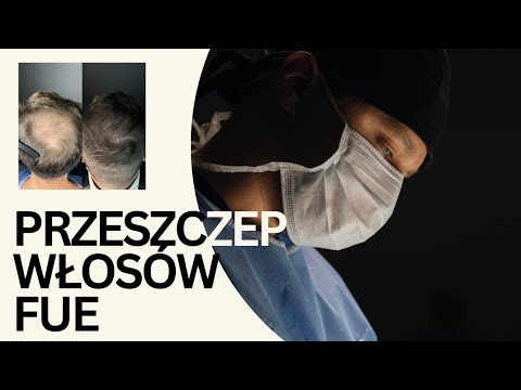 Piotr  Turkowski-53