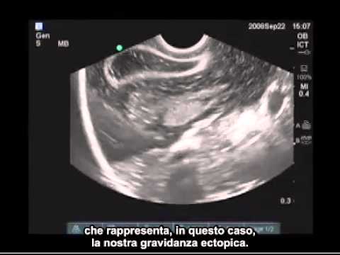 Se un mal di collo refrigerata Mal di colonna vertebrale e delle articolazioni cause