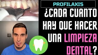 ¿CADA CUANTO hay que realizarse una LIMPIEZA DENTAL - Profilaxis bucal