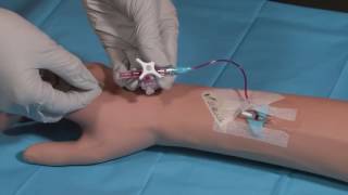 Product video: BD Nexiva Closed IV Catheter System - 18 - 24 Gauge