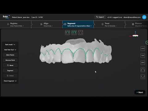 Refine Kea AI Segmentation (Maxilla)
