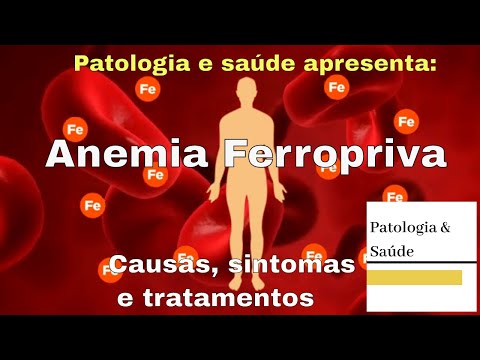 Anemia Ferropriva: Causas, sintomas e tratamentos.