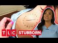 Dr Lee Deals With A Stubborn Lipoma Dr Pimple Popper This Is Zit