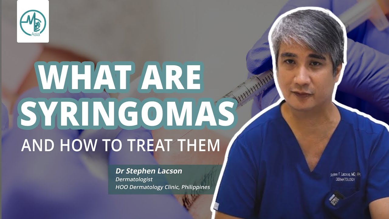 Dermatologist's Guide To Syringoma | Dr Stephen Lacson (Dermatologist)