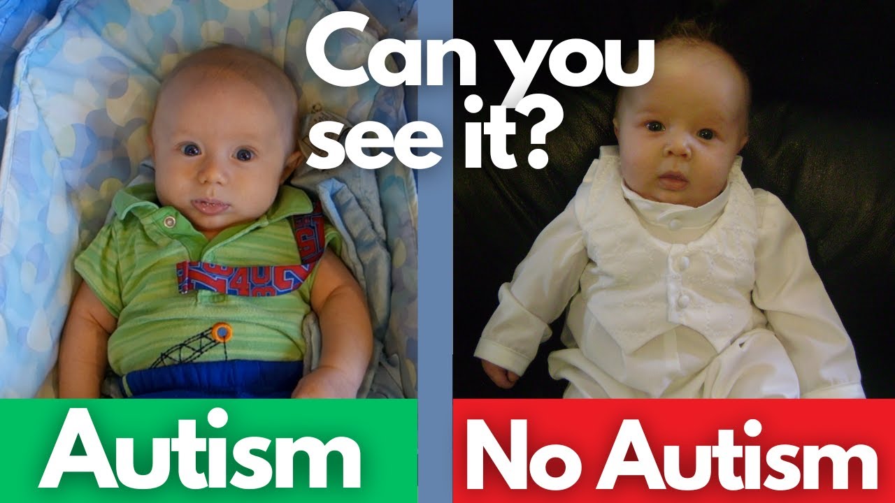 12 Signs of Autism in Babies