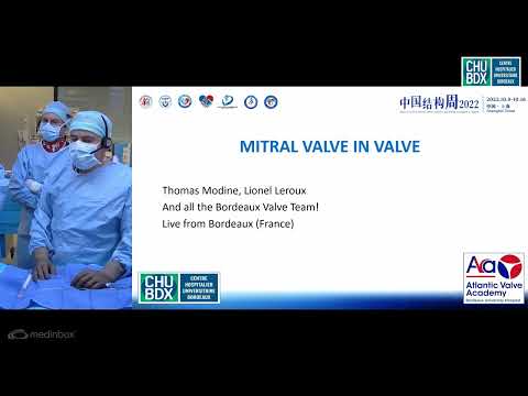 MITRAL VALVE IN VALVE - CHINA STRUCTURAL WEEK 2022   THOMAS MODINE LIONEL LEROUX