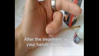 How to remove yellow stains on fingers, caused fro