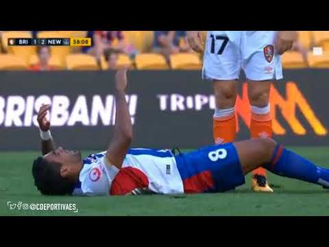 Ronald Vargas se fracturó la tibia y el peroné en Australia